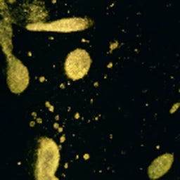 Gold Splatter